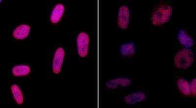 Immunocytochemistry/Immunofluorescence Staining of Histone H2AX in Treated and Untreated HeLa Cells